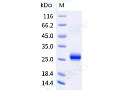 Sino Biological Recombinant Mouse CD70/CD27 Ligand Protein (ECD, His &