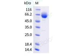 Sino Biological Recombinant Human CD36 Protein (ECD, His & AVI Tag), Biotinylated,