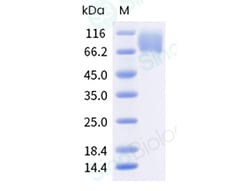 Sino Biological Recombinant Cynomolgus TrkA Protein (ECD, His Tag), HPLC-verified,