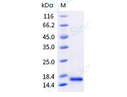 Sino Biological Recombinant Human GDNF Protein, HPLC-verified, Quantity: