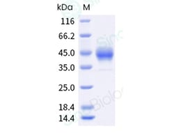Sino Biological Recombinant Cynomolgus, Rhesus LIF Protein (His & AVI Tag),