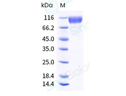 Sino Biological Recombinant Cynomolgus PDGF alpha receptor/PDGFRA Protein