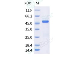 Sino Biological Recombinant Human Calreticulin/CALR Protein, HPLC-verified,