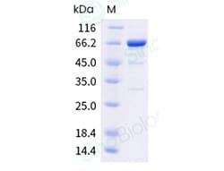 Sino Biological Influenza A H5N8 (A/Astrakhan/3212/2020) Hemagglutinin