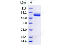 Sino Biological Recombinant Human CTHRC1 Protein (hFc Tag), HPLC-verified,