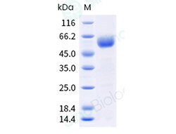 Sino Biological Recombinant Human BTLA Protein (hFc Tag), HPLC-verified,