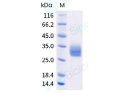 Sino Biological Recombinant Human BTLA Protein (isoform1, His Tag), HPLC-verified,