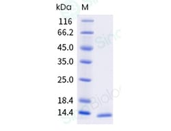 Sino Biological Recombinant Betula verrucosa Bet v 2 Protein, Quantity: