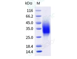 Sino Biological Recombinant Mouse BTLA Protein (His Tag), HPLC-verified,