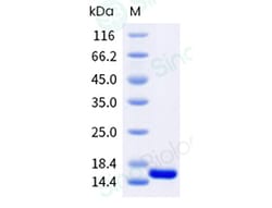 Sino Biological Recombinant Dermatophagoides pteronyssinus Der p 21 Protein,