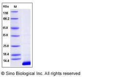 Sino Biological Recombinant Human S100B Protein (His Tag), HPLC-verified,