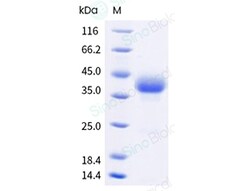 Sino Biological Recombinant Human OX40/TNFRSF4 Protein (His & AVI Tag),