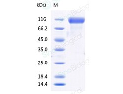 Sino Biological Recombinant Cynomolgus Her2/ERBB2 Protein (ECD, His & AVI