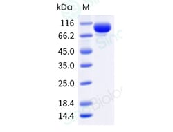 Sino Biological Influenza A H3N2 (A/Darwin/9/2021) Hemagglutinin / HA trimer