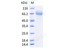 Sino Biological Recombinant Cynomolgus LRRC15 Protein (ECD, His Tag), HPLC-verified,
