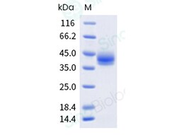 Sino Biological Recombinant Mouse 4-1BB/CD137 Protein (His & AVI Tag),