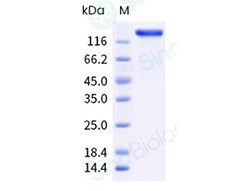 Sino Biological Recombinant Human L1CAM Protein (His & AVI Tag), Biotinylated,
