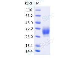 Sino Biological Recombinant Mouse CTLA-4 Protein (His & AVI Tag), Biotinylated,