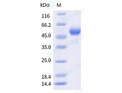 Sino Biological Recombinant Human Carbonic Anhydrase IX/CA9 Protein (ECD,