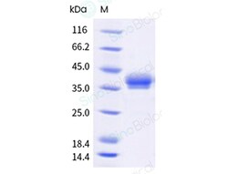 Sino Biological Recombinant Human carbonic anhydrase XII/CA12 Protein (His