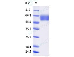 Sino Biological Recombinant Human IL-18Rα Protein (ECD, His Tag), Amine-Labeled