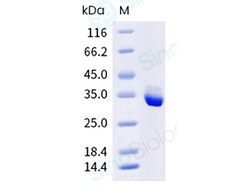 Sino Biological Recombinant Mouse Complement component 3 Protein (His Tag),