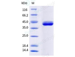 Sino Biological Recombinant Scylla paramamosain Scy p 1 Protein, Quantity: