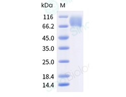Sino Biological Recombinant Cynomolgus TrkA Protein (ECD, His Tag), HPLC-verified,