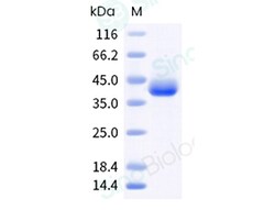 Sino Biological Recombinant Human ILT3/LILRB4 Protein (ECD, His & AVI Tag),