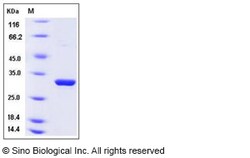 Sino Biological Recombinant Human LMAN2 Protein (His Tag), HPLC-verified,