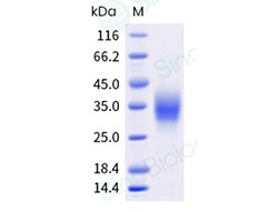 Sino Biological Recombinant Human BTLA Protein (His & AVI Tag), Biotinylated,