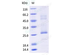 Sino Biological Recombinant Human Claudin18 Protein (CLDN18.2, Full-Length,