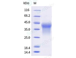 Sino Biological Recombinant Human HVEM Protein (ECD, His & AVI Tag), Biotinylated,