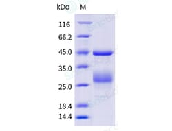 Sino Biological Recombinant Human MMP-10/MMP10 Protein (His Tag), Quantity: