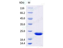 Sino Biological Recombinant Human FGF-21 Protein, Quantity: Each of 1