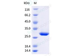Sino Biological Recombinant Human C-Reactive Protein (His & AVI Tag), Biotinylated,