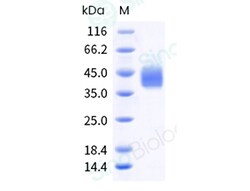 Sino Biological Recombinant Cynomolgus Mesothelin Protein (His Tag), HPLC-verified,