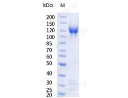 Sino Biological Recombinant Human LDLR/LDL Receptor Protein (mFc Tag),
