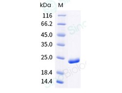 Sino Biological Recombinant Human Farnesoid X receptor/FXR Protein (His