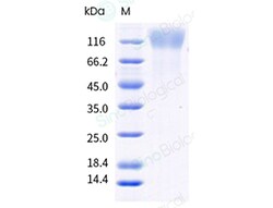 Sino Biological Recombinant Cynomolgus CEACAM-5/CD66e Protein (His & AVI