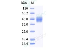 Sino Biological Recombinant Human Mesothelin Protein (His & AVI Tag), Biotinylated,