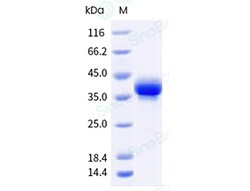 Sino Biological Recombinant Human FOLR1 Protein (ECD, His & AVI Tag), Biotinylated,