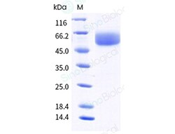 Sino Biological Recombinant Human Siglec-7 Protein (ECD, His Tag), HPLC-verified,