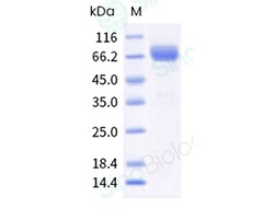 Sino Biological Recombinant Human Mesothelin Protein (hFc & AVI Tag), Biotinylated,