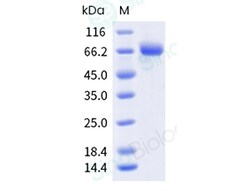 Sino Biological Recombinant Human Tissue Factor Protein (hFc & AVI Tag),