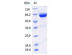 Sino Biological Recombinant Human FOLR1 Protein (ECD, hFc & AVI Tag), Biotinylated,