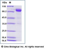 Sino Biological Recombinant Human SIRP gamma/SIRPG Protein (hFc Tag), Quantity: