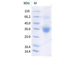 Sino Biological Human CLU Protein 100UG 11297-H08H1-100, Quantity: Each
