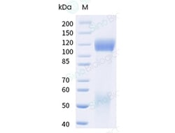 Sino Biological Recombinant Human IGF1R Protein (ECD, His & AVI Tag), Biotinylated,