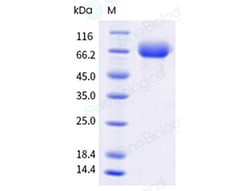 Sino Biological Recombinant Human ILT4/LILRB2 Protein (ECD, His & AVI Tag),